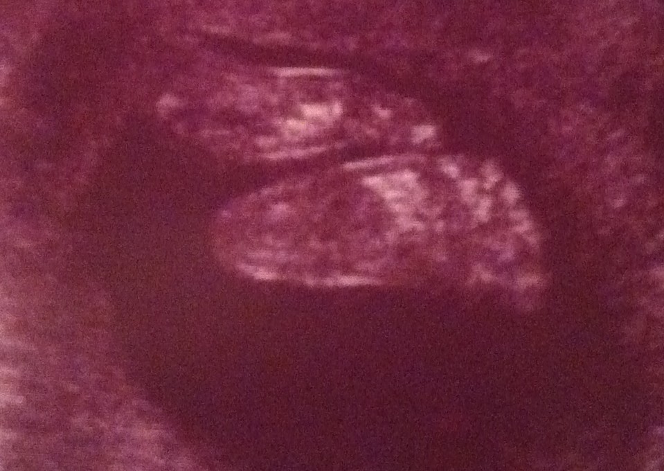 Baby's footprint